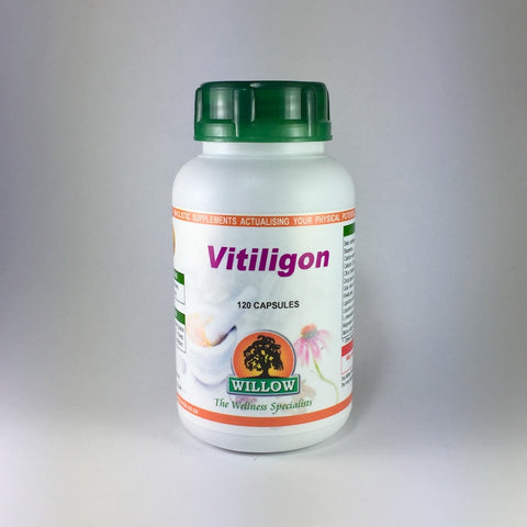 Vitiligon